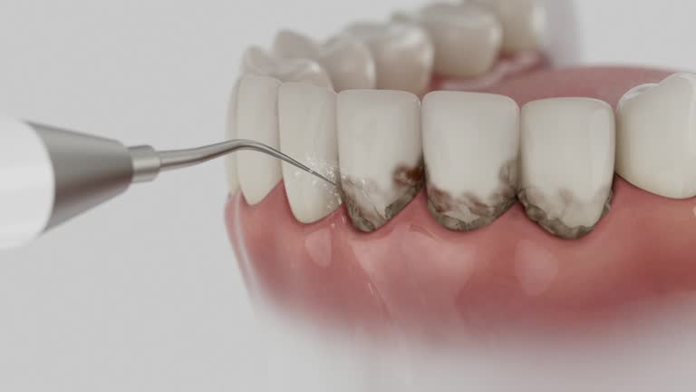 Reliable Dental contractor in Cedar Rapids, IA by Smile Center Dentistry